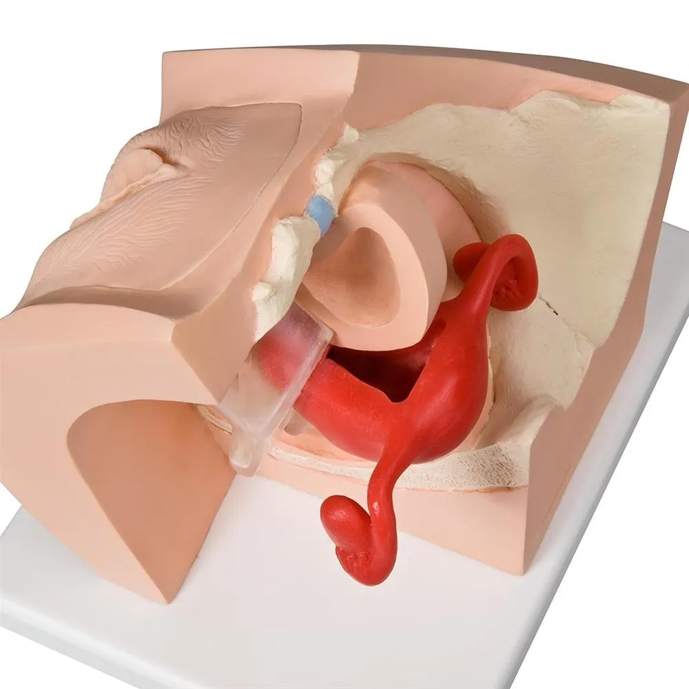 Gynecological Patient Education Model