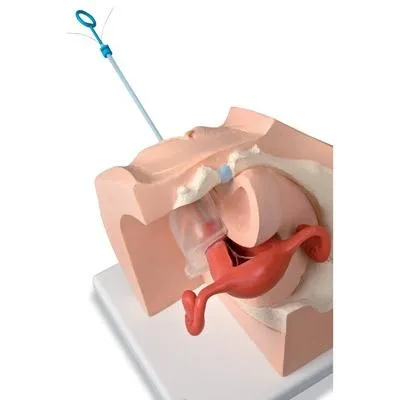 Gynecological Patient Education Model